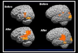 Brain Training: How it helps many students including those with an Individualized Education Plan (I.E.P.)